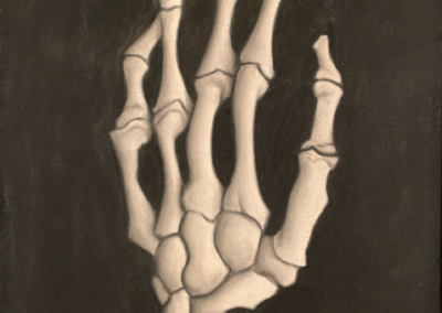Skeletal